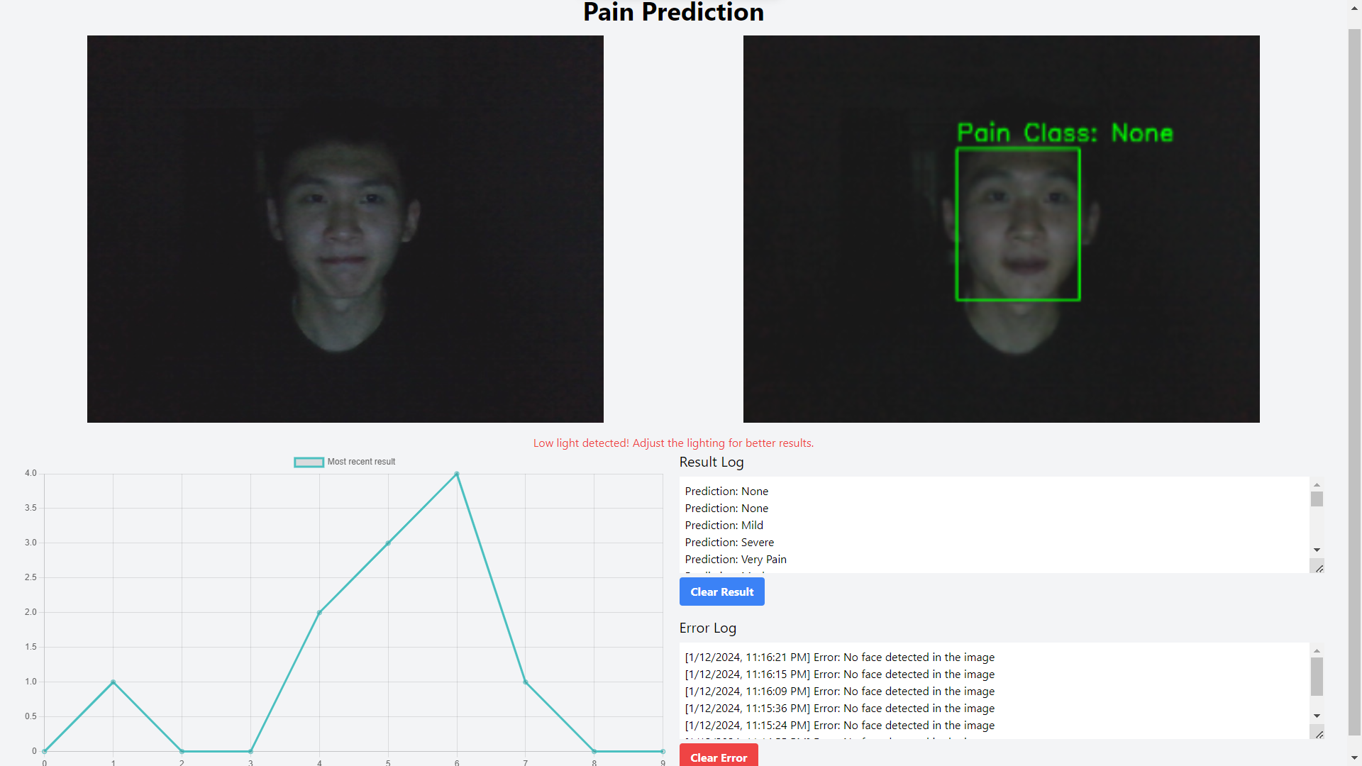 Automated Recognition of Facial Expression of Pain using Machine Learning